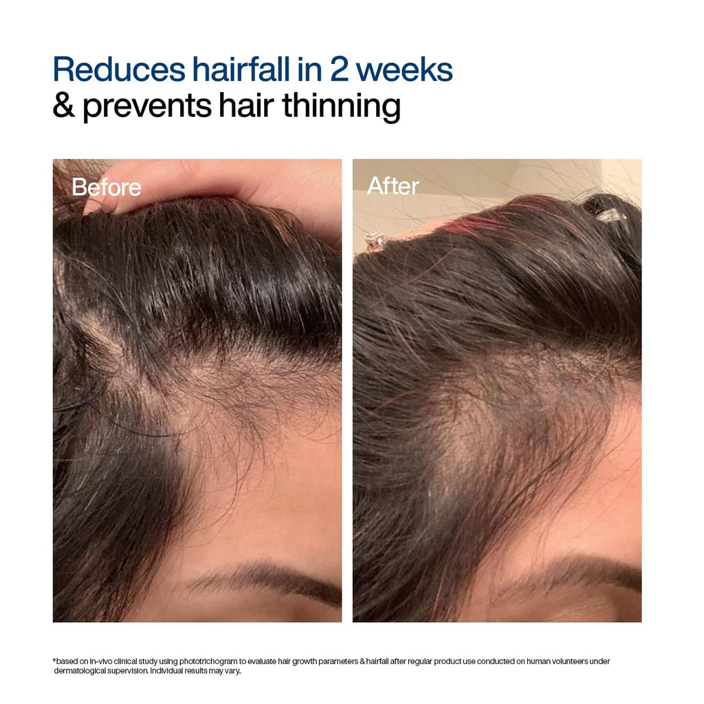 WishCare Hair Growth Serum