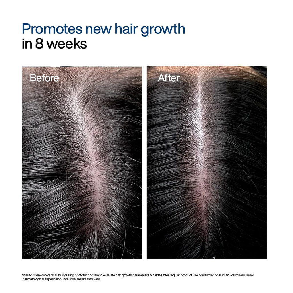 WishCare Hair Growth Serum