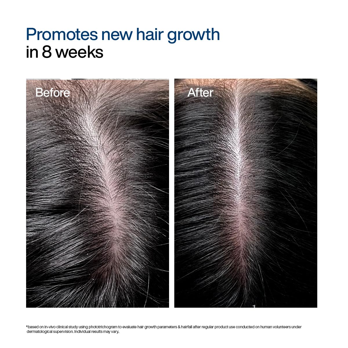 WishCare Hair Growth Serum